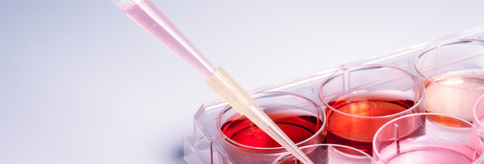 Intellectual property